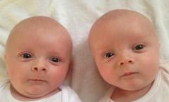 Jednojajčani i jednojajčani blizanci: razlike Kada se identificiraju jednojajčani blizanci