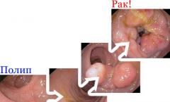 Penilaian kondisi mukosa mulut Penebalan dinding lambung yang tidak merata FGS